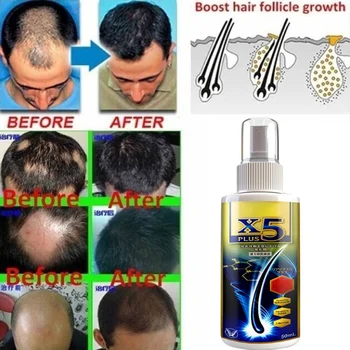 Haarverlies Haar Natuurlijke Snelle Groei van de Essentiële Olie van het Product Anti-Haaruitval Behandeling Groei Essentie Alopecia Haar Behandeling voor Vrouwen