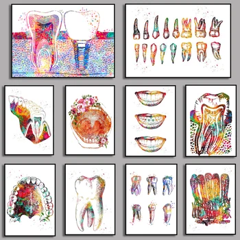 Tand Implantaat Tandarts Anatomie Prints, Canvas Muurschildering Dental Art Poster Medische Kunst Aan De Muur, Foto ' S Hospital Clinic Decoratie